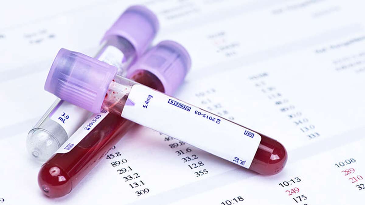 Varias muestras de sangre.