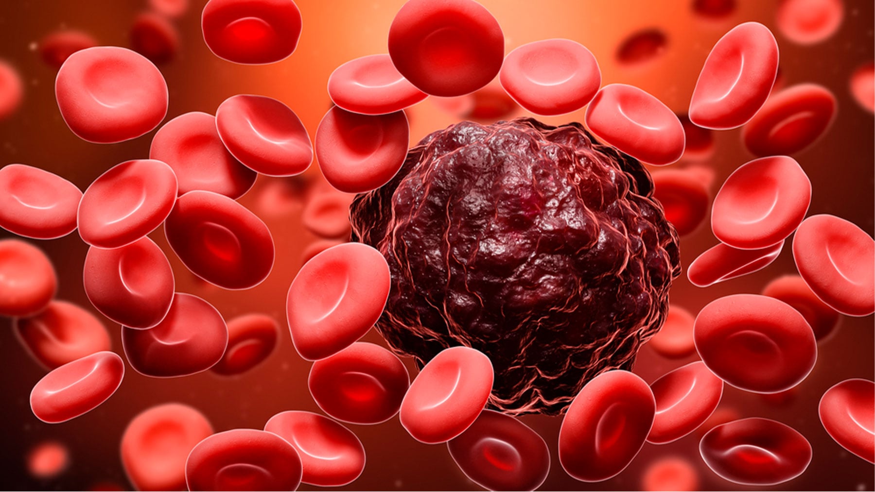Una muestra del cáncer en sangre.