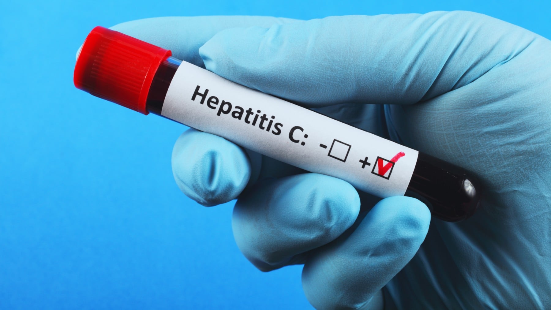 Una nueva investigación para tratar la hepatitis.