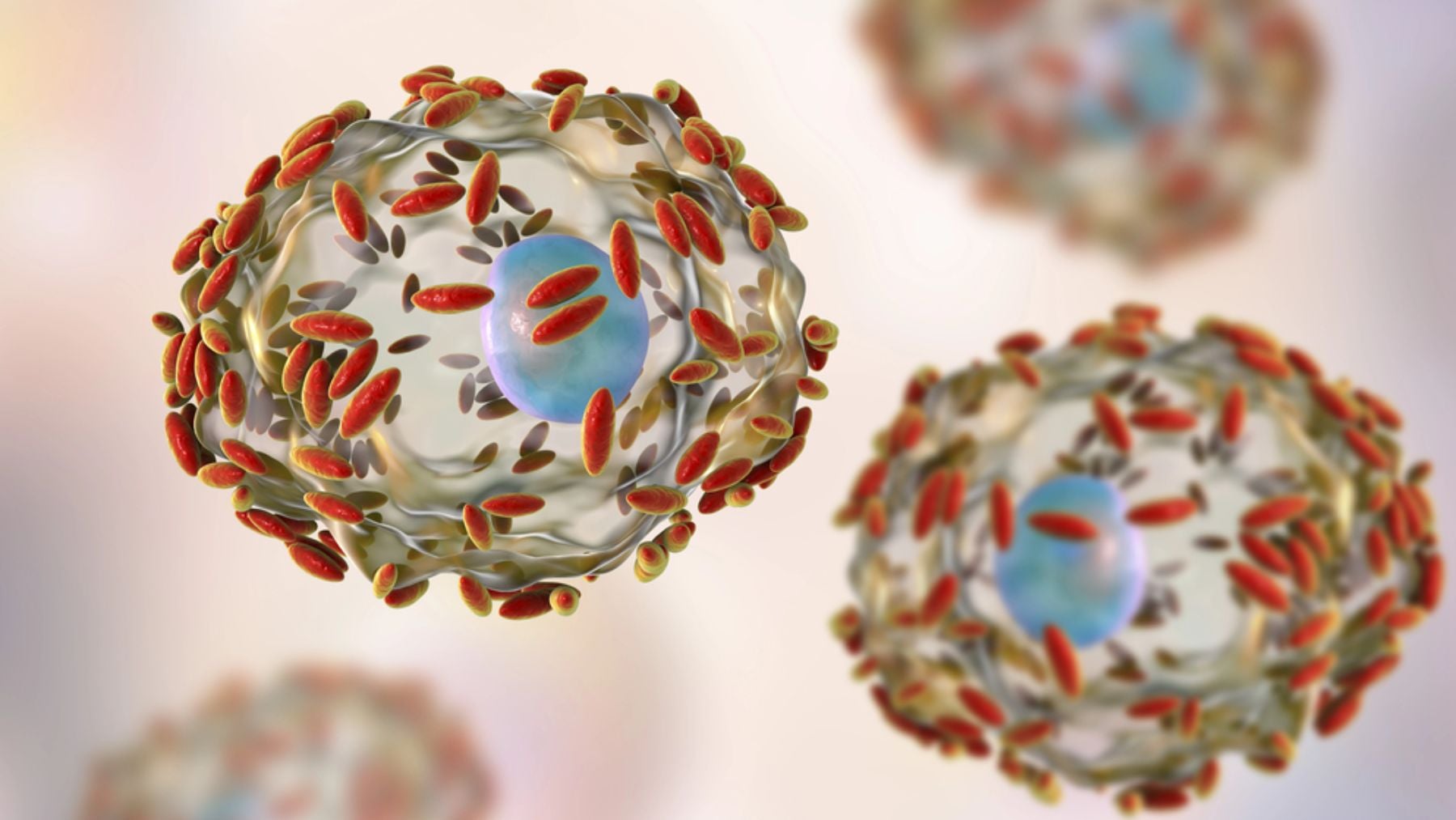 Así se ve la vaginosis bacteriana al microscopio.