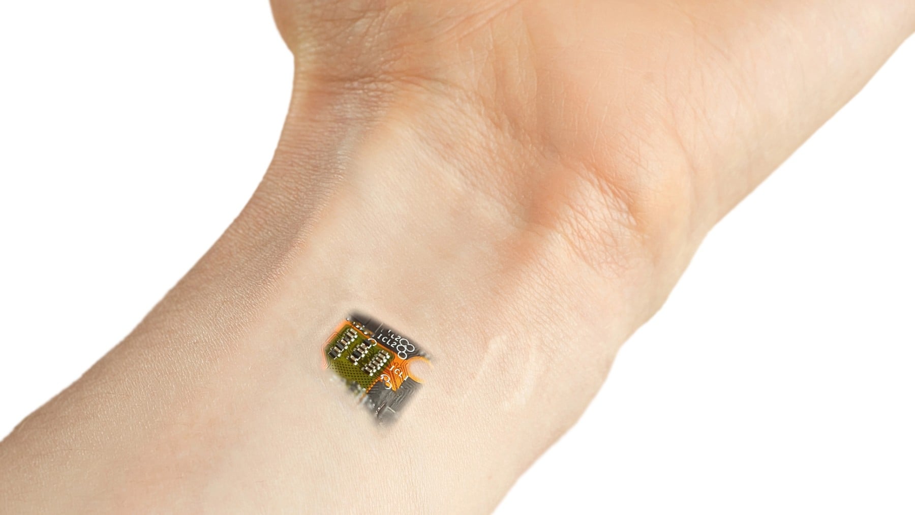 Implantan un micro chip en el brazo a una persona.