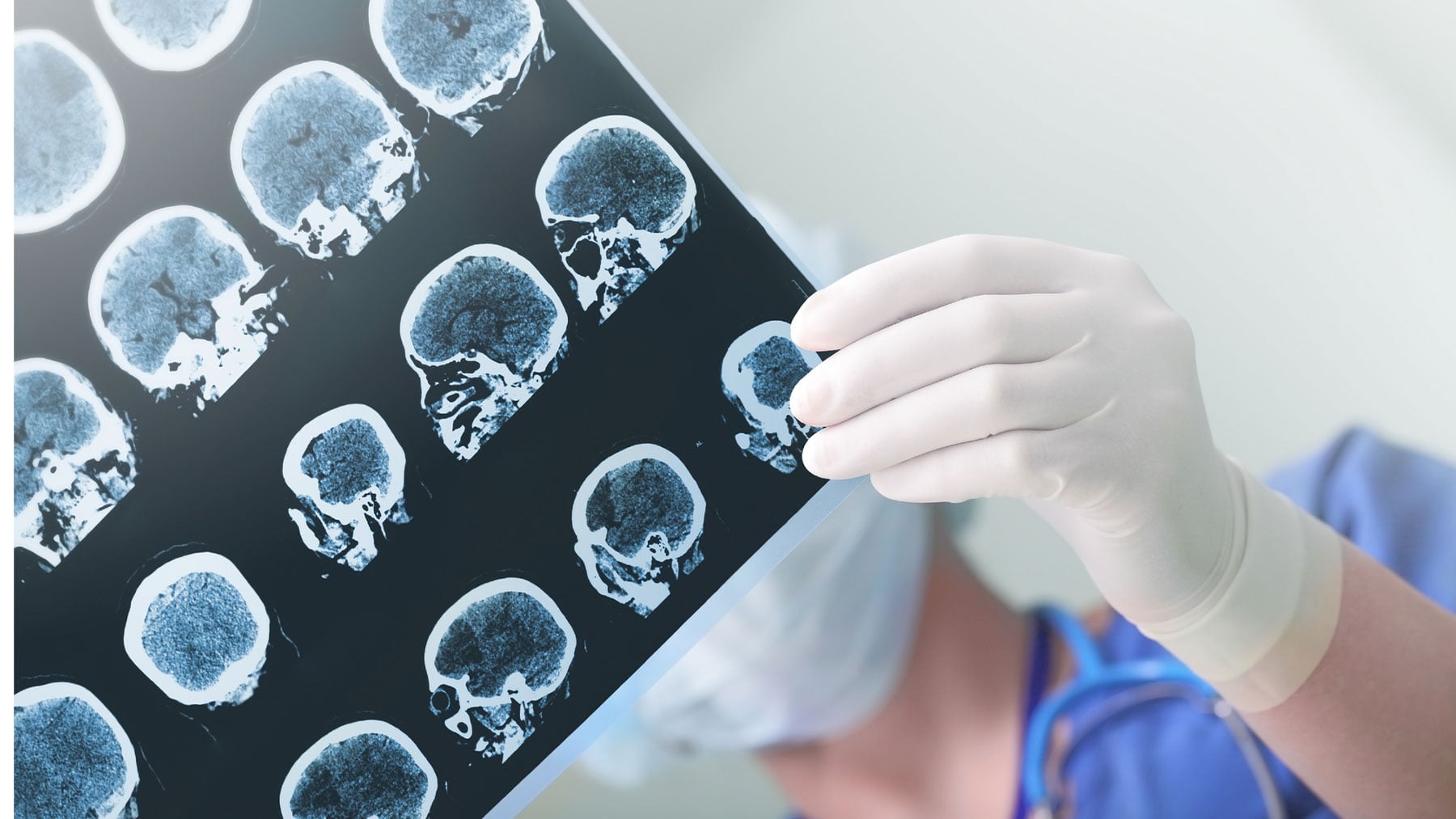 Un médico sostiene una prueba de resonancia magnética.